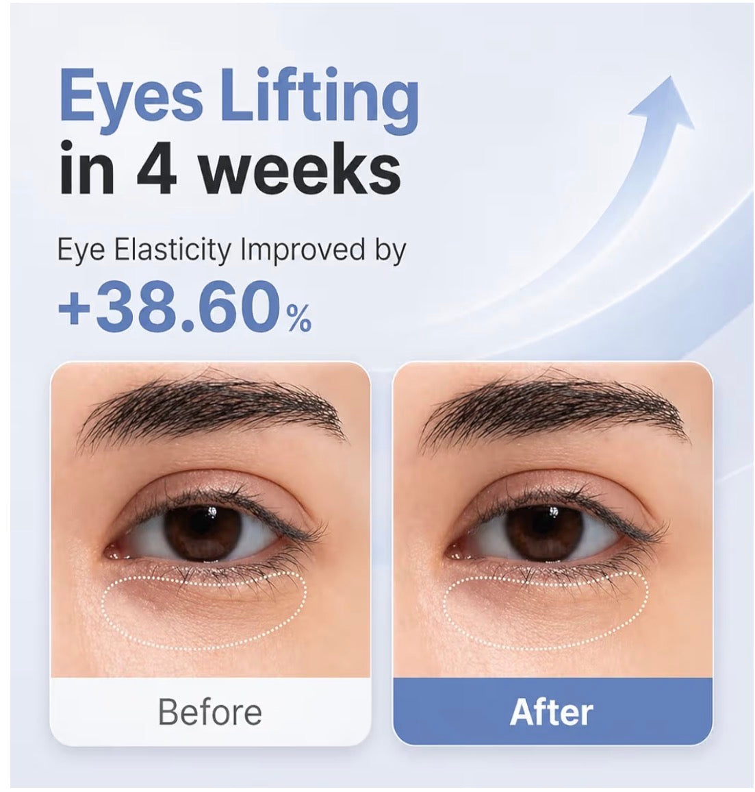 AROCELL Wrinkle Eye Cream– 12000 Vibrations/min Eye Cream with Collagen & Galvanic Care, Hydrating Moisturizing, Elasticity Boosting
