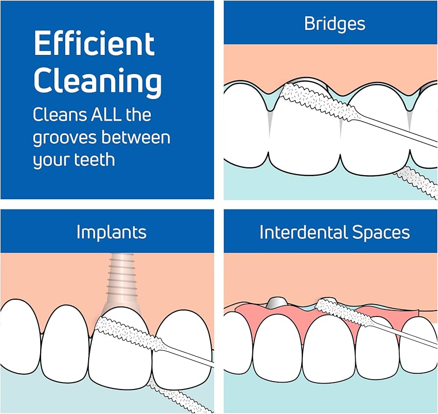 Tepe-Bridge & Implant Floss
