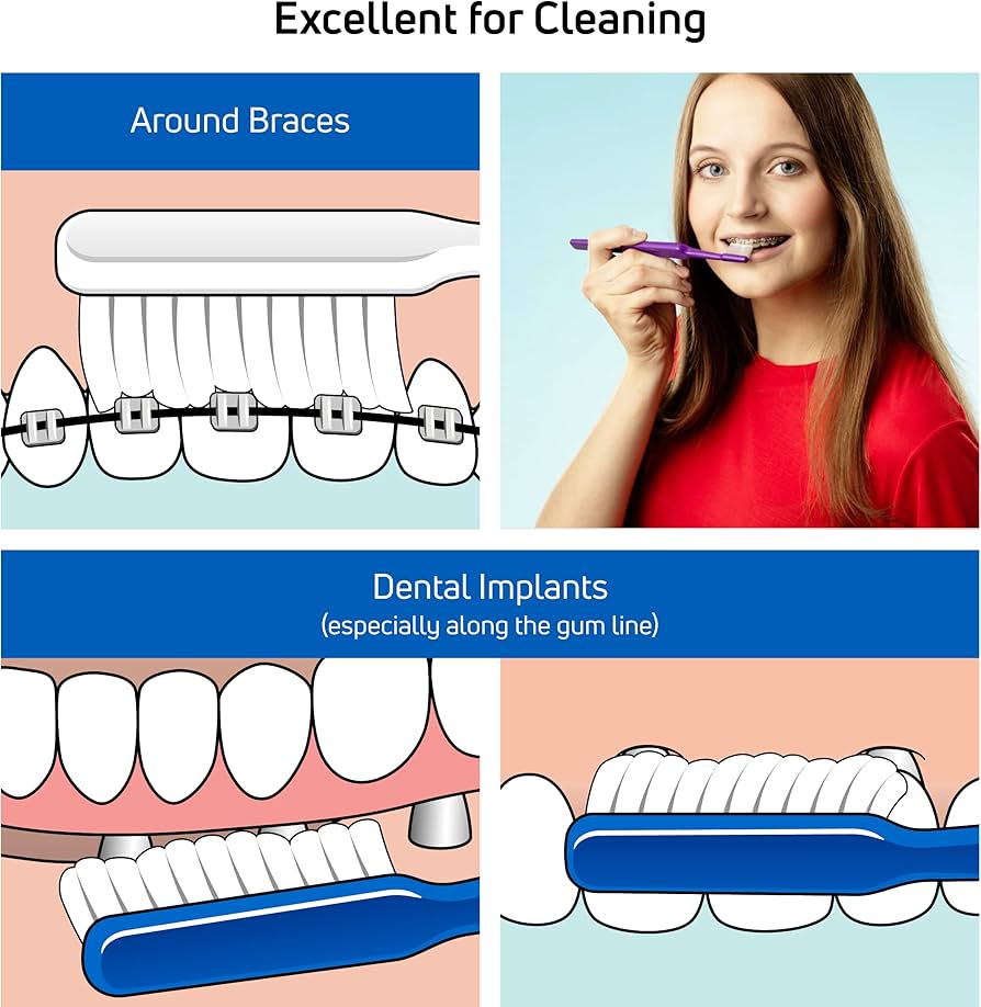TEPE-IMPLANT ORTHODONTIC BRUSH